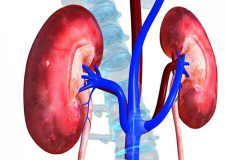 سنگ کلیه شایع ترین بیماری کلیوی در استان آذربایجان شرقی