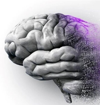 هورمون درمانی برای یائسگی با علائم آلزایمر مرتبط است