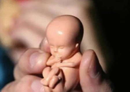 دلایل اصلی سقط‌ های عمدی