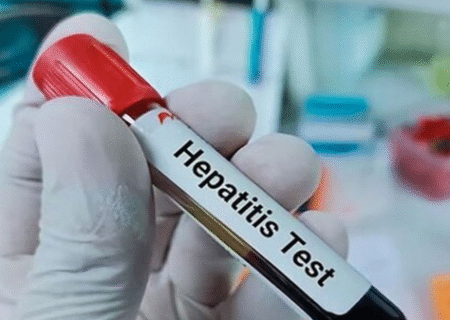 هشدار شیوع بالای هپاتیت A در کودکان و نوجوانان ایرانی